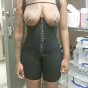 Smash or pass? Before n after ass shots