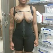 Smash or pass? Before n after ass shots