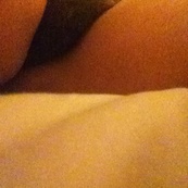 dmv witey hairy yellow