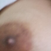 Tits